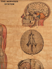 Vintage Anatomical Medical Poster On Canvas By R.T.
